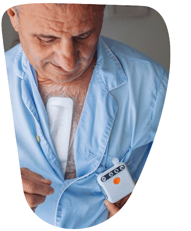 PICO on cardiac patient