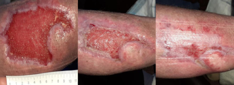 Complex venus case study